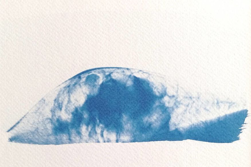 photogrpahie mammographie paysage interieur